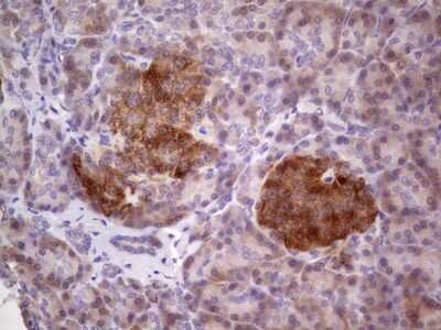 Immunohistochemistry: TACC1 Antibody (OTI1H2) [NBP2-46057]