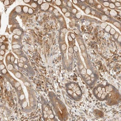 Immunohistochemistry-Paraffin: TACC1 Antibody [NBP1-89447]