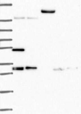 Western Blot: TACC1 Antibody [NBP3-17316]