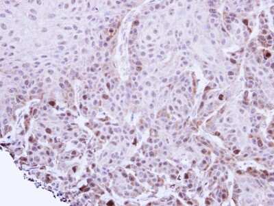 Immunohistochemistry-Paraffin: TACC2 Antibody [NBP1-31221]
