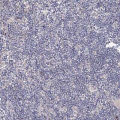 Immunohistochemistry-Paraffin: TACC2 Antibody [NBP1-88926]