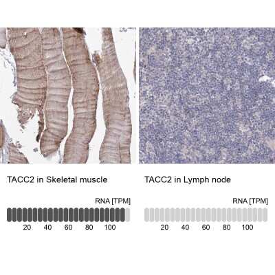 Immunohistochemistry-Paraffin: TACC2 Antibody [NBP1-88926]