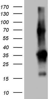 Western Blot: TACC2 Antibody (OTI3C4)Azide and BSA Free [NBP2-74430]