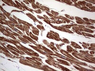 Immunohistochemistry: TACC2 Antibody (OTI3C4) [NBP2-46058]