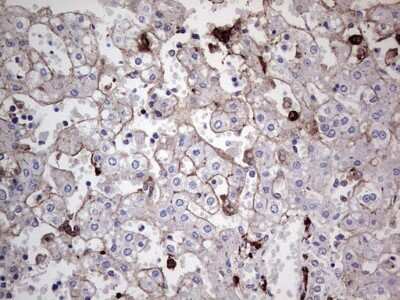 Immunohistochemistry: TACC2 Antibody (OTI3C4) [NBP2-46058]