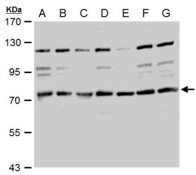 Western Blot: TACC2 Antibody [NBP1-31221]