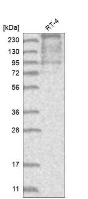 Western Blot: TACC2 Antibody [NBP2-38173]