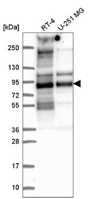 Western Blot: TACC2 Antibody [NBP2-57227]