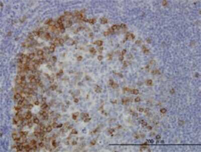 Immunohistochemistry-Paraffin: TACC3 Antibody (6C4) [H00010460-M02]