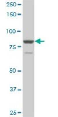 Western Blot: TACC3 Antibody (6C4) [H00010460-M02]