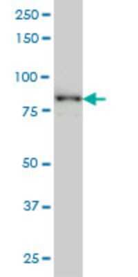 Western Blot: TACC3 Antibody (6C4) [H00010460-M02]