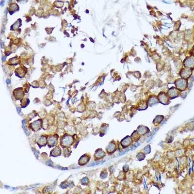 Immunohistochemistry-Paraffin: TACC3 Antibody (7S7L2) [NBP3-15816]