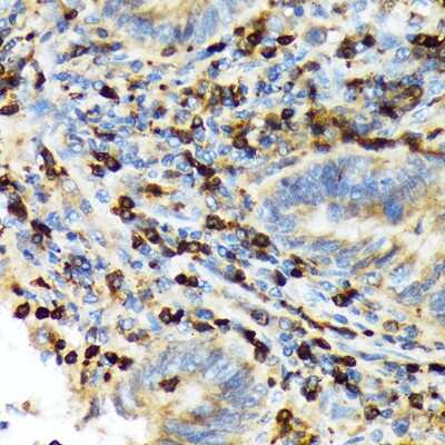 Immunohistochemistry-Paraffin: TACC3 Antibody (7S7L2) [NBP3-15816]