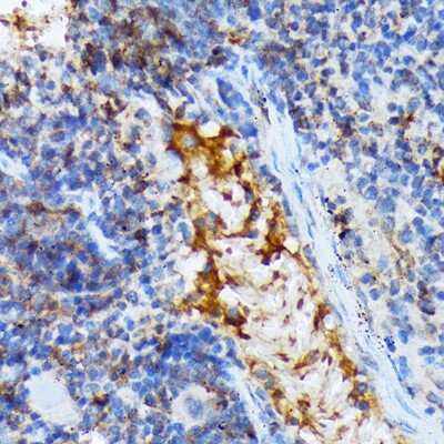 Immunohistochemistry-Paraffin: TACC3 Antibody (7S7L2) [NBP3-15816]