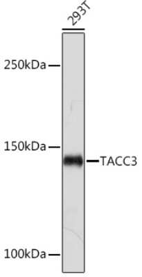 Western Blot: TACC3 Antibody (7S7L2) [NBP3-15816]