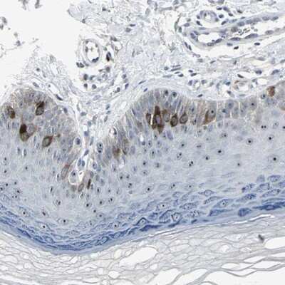 Immunohistochemistry-Paraffin: TACC3 Antibody [NBP1-84811]