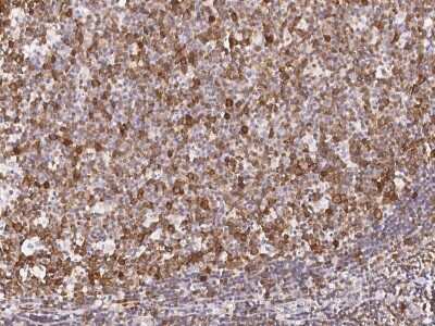 Immunohistochemistry-Paraffin: TACC3 Antibody [NBP2-98919]