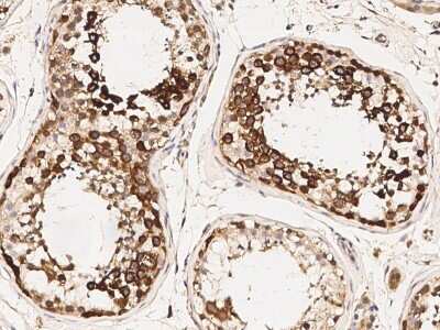 Immunohistochemistry-Paraffin: TACC3 Antibody [NBP2-98919]