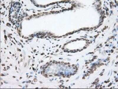 Immunohistochemistry: TACC3 Antibody (OTI6F1) - Azide and BSA Free [NBP2-74436]