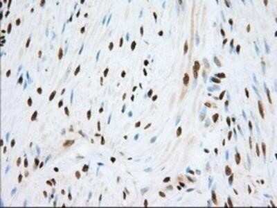 Immunohistochemistry: TACC3 Antibody (OTI6F1) - Azide and BSA Free [NBP2-74436]