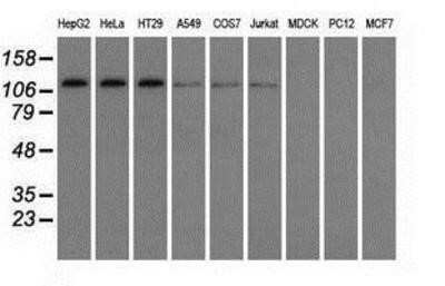 Western Blot: TACC3 Antibody (OTI6F1)Azide and BSA Free [NBP2-74436]