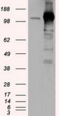 Western Blot: TACC3 Antibody (OTI6F1)Azide and BSA Free [NBP2-74436]