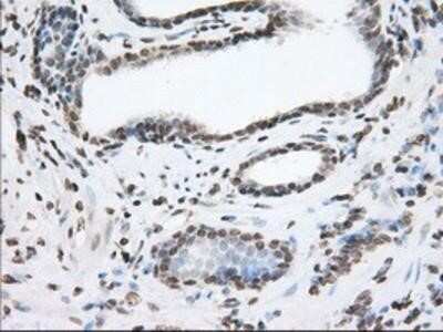 Immunohistochemistry-Paraffin: TACC3 Antibody (OTI6F1) [NBP2-02619]