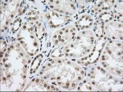 Immunohistochemistry-Paraffin: TACC3 Antibody (OTI6F1) [NBP2-02619]