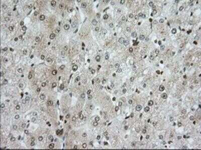 Immunohistochemistry-Paraffin: TACC3 Antibody (OTI6F1) [NBP2-02619]