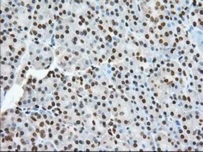 Immunohistochemistry-Paraffin: TACC3 Antibody (OTI6F1) [NBP2-02619]