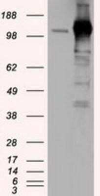 Western Blot: TACC3 Antibody (OTI6F1) [NBP2-02619]