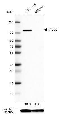 Western Blot: TACC3 Antibody [NBP1-84810]