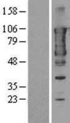 Western Blot: TACC3 Overexpression Lysate [NBL1-16671]