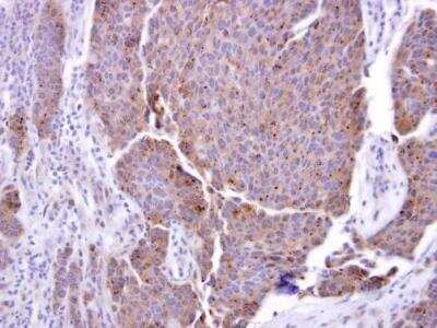 Immunohistochemistry-Paraffin: TACE/ADAM17 Antibody [NBP2-15281]