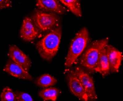 Immunocytochemistry/ Immunofluorescence: TACE/ADAM17 Antibody (JM10-35) [NBP2-67179]