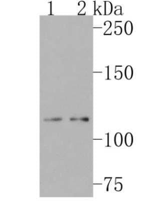 Western Blot: TACE/ADAM17 Antibody (JM10-35) [NBP2-67179]