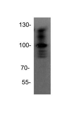 Western Blot: TACE/ADAM17 AntibodyBSA Free [NBP1-77044]