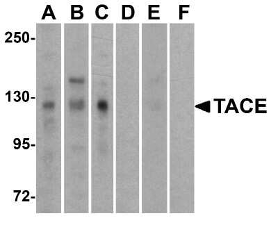 Western Blot: TACE/ADAM17 AntibodyBSA Free [NBP1-77044]