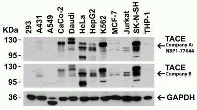Western Blot: TACE/ADAM17 AntibodyBSA Free [NBP1-77044]