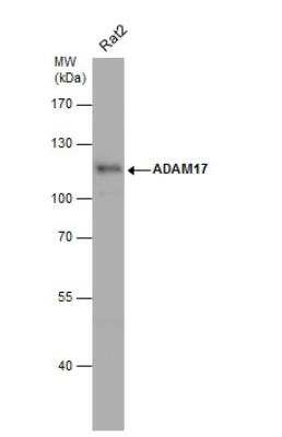Western Blot: TACE/ADAM17 Antibody [NBP2-15281]