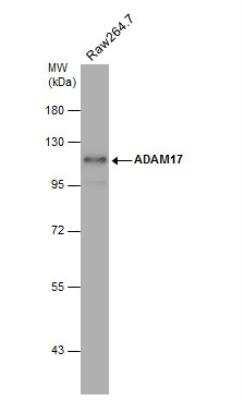 Western Blot: TACE/ADAM17 Antibody [NBP2-15281]