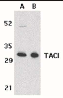 Western Blot: TACI/TNFRSF13B/CVID AntibodyBSA Free [NBP1-76779]