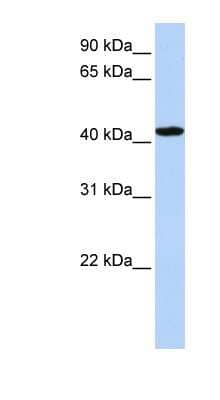 Western Blot: TADA1L Antibody [NBP1-56629]