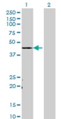 Western Blot: TADA3L Antibody (3H3) [H00010474-M02]