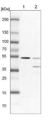 Western Blot: TADA3L Antibody [NBP1-90243]