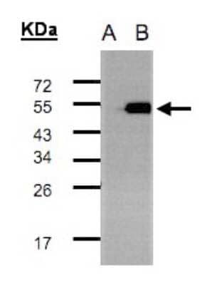 Western Blot: TADA3L Antibody [NBP2-20554]