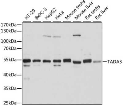 Western Blot: TADA3L AntibodyAzide and BSA Free [NBP2-94077]