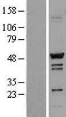 Western Blot: TADA3L Overexpression Lysate [NBL1-16678]