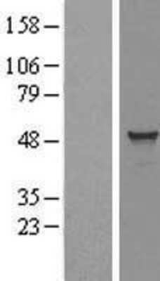 Western Blot: TADA3L Overexpression Lysate [NBL1-16679]