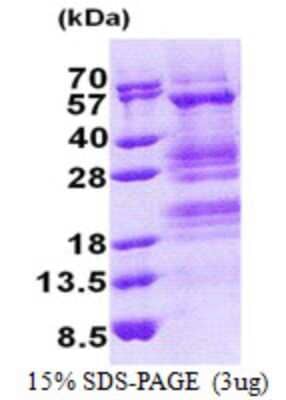 SDS-PAGE: Recombinant Human TADA3L His Protein [NBP2-22879]